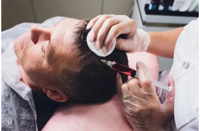  Sapphire hair transplant  in Turkey