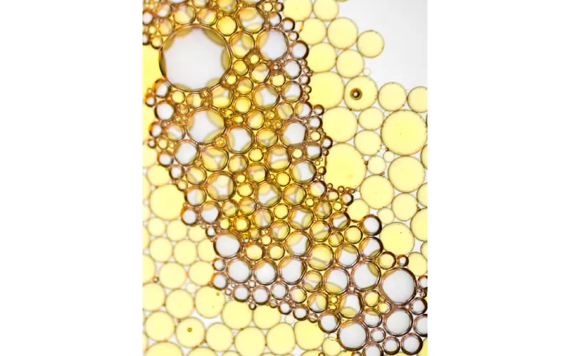 How to Isolate Mesenchymal Stem Cells from Tissue?