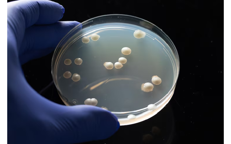 How to Plan for Stem Cell Preservation Charges?